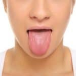 acupuncture and the tongue 